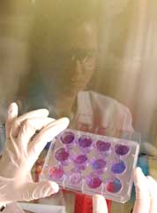 Reflection of a researcher with plastic plate of cells.